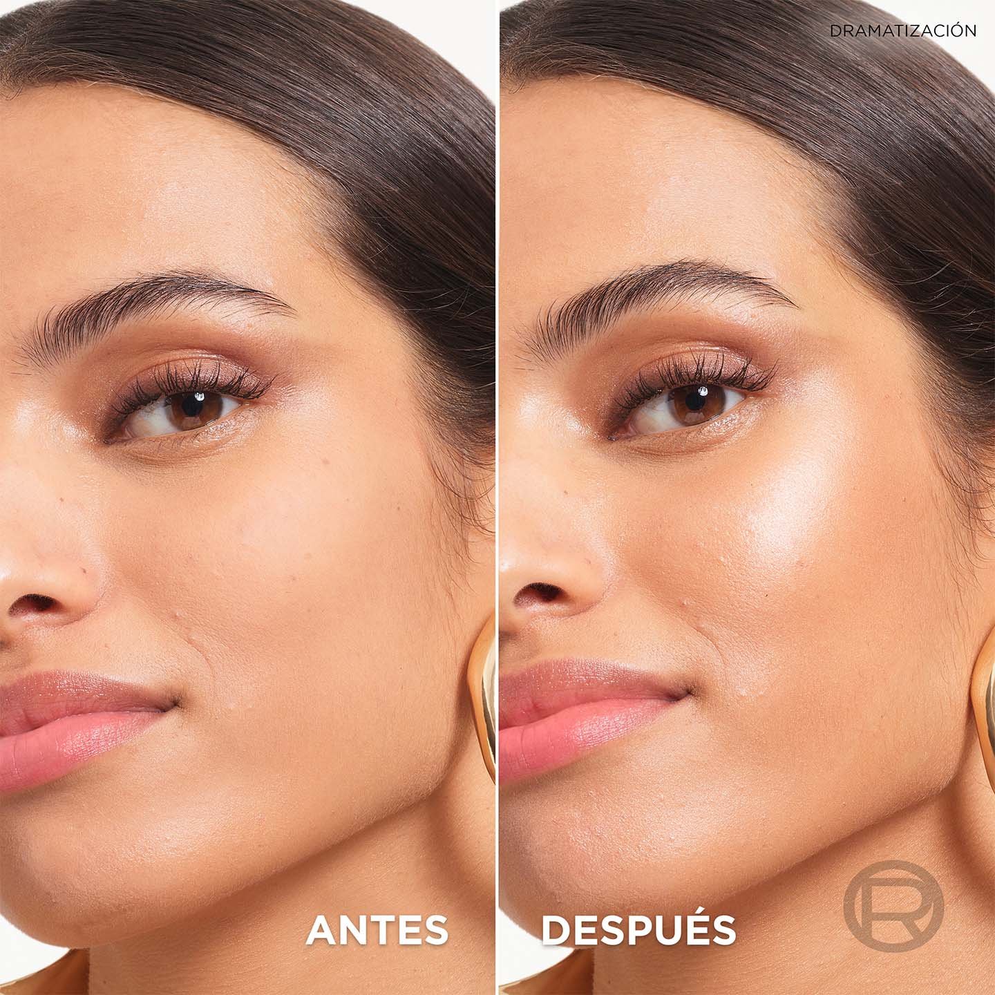 Lumi Glotion Antes Despues